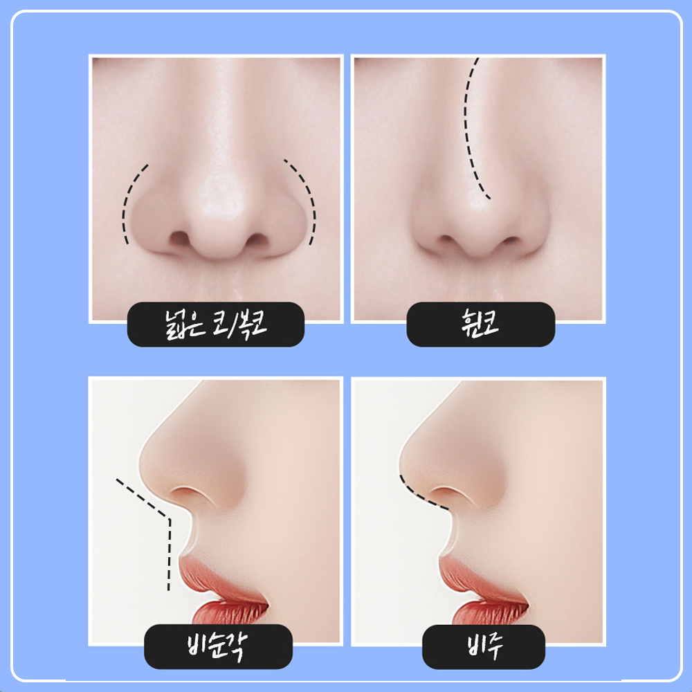 비순각.jpg
