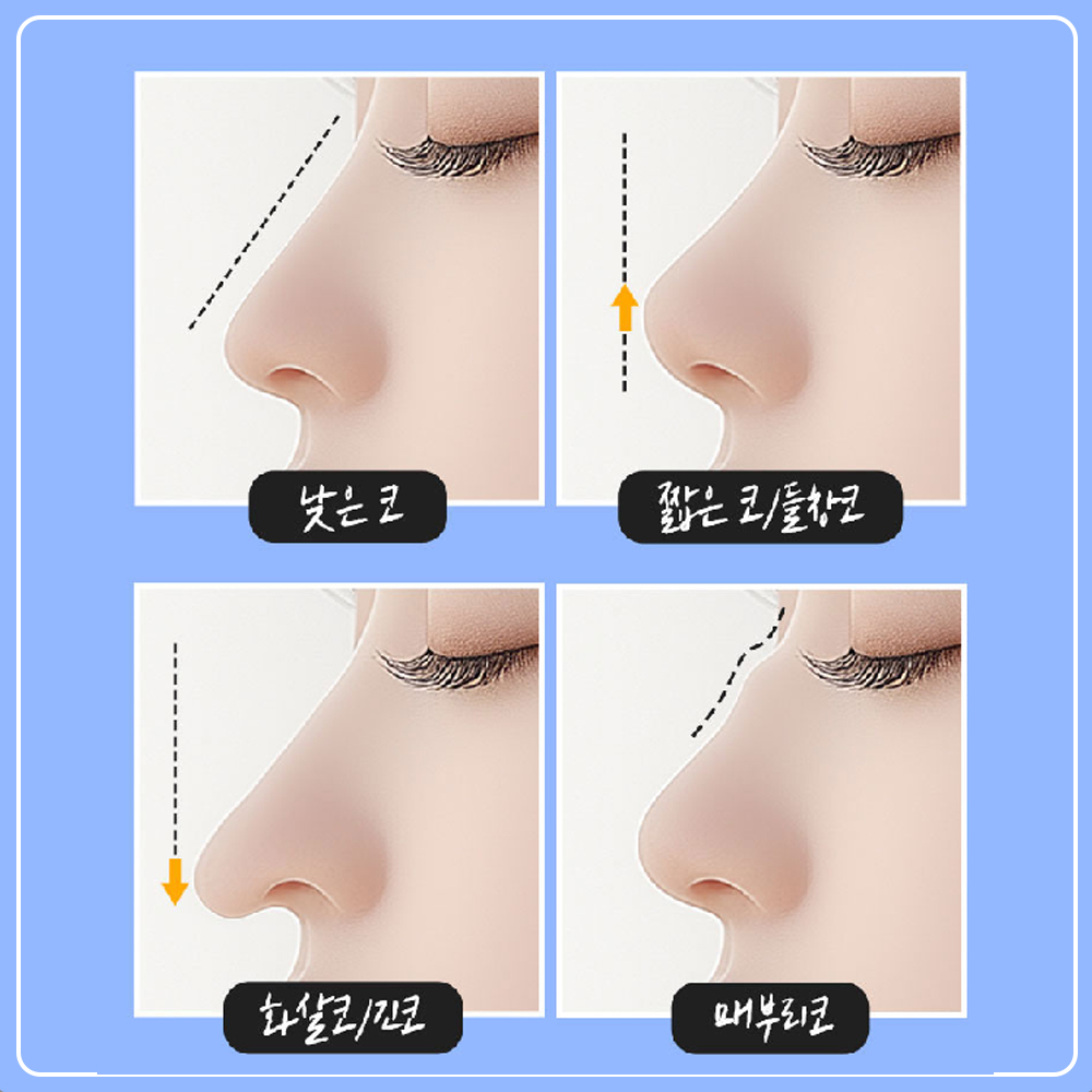 낮은코-메부리코.jpg