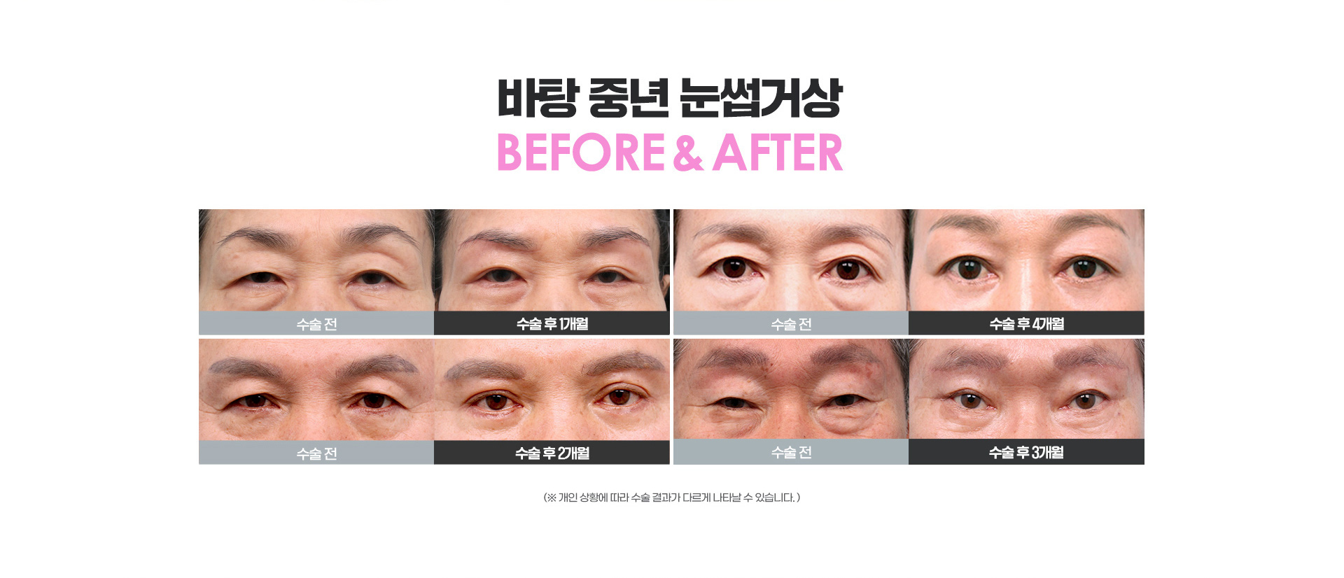 바탕성형외과