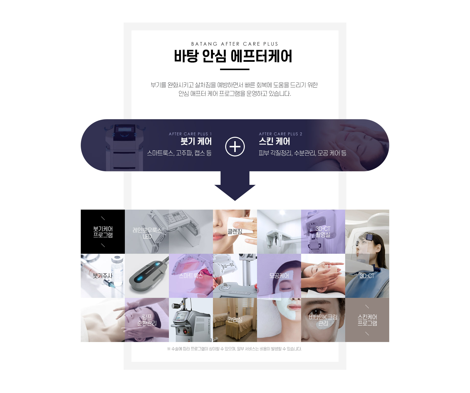 안면윤곽