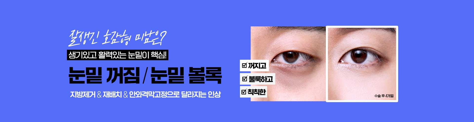바탕남자눈성형외과