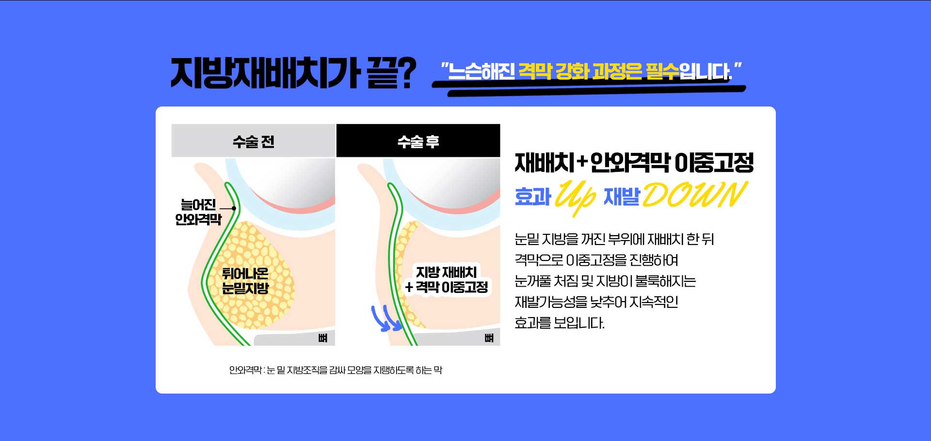 바탕남자눈성형외과