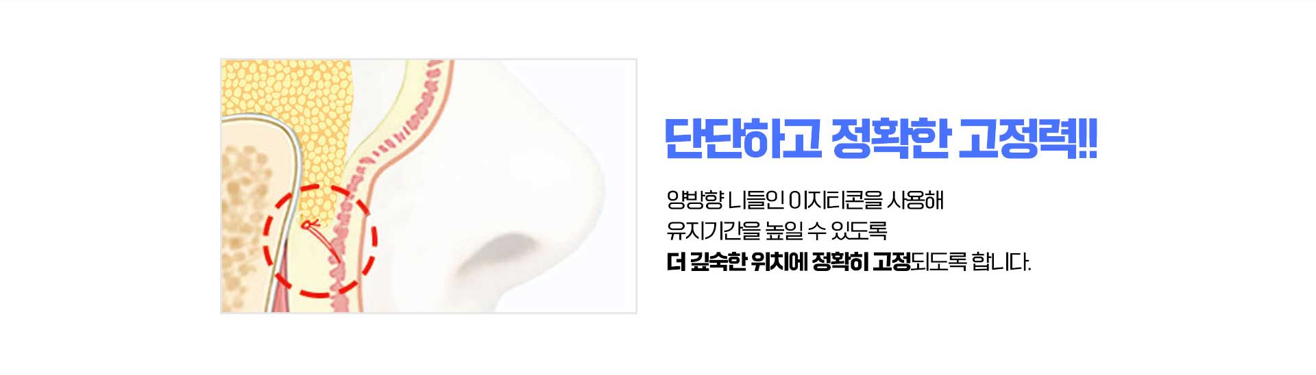 바탕남자눈성형외과