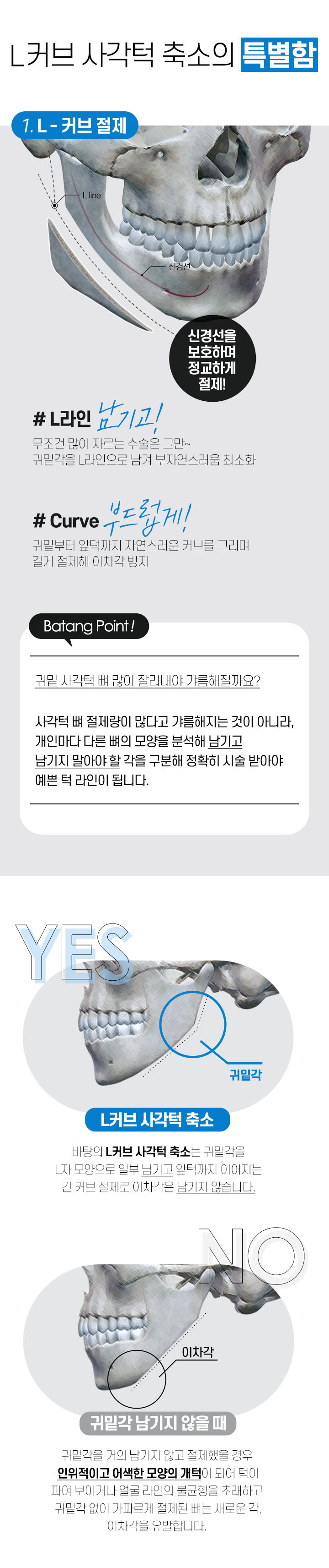 L커브 사각턱축소의 특별함