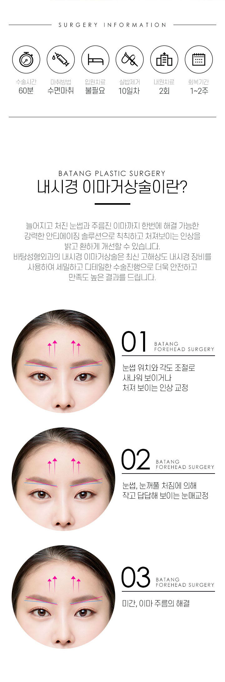 이마성형