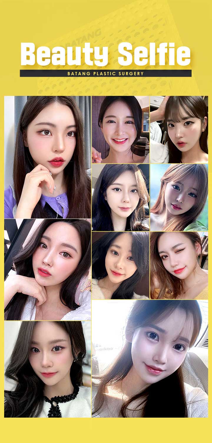 바탕 내시경 이마거상술