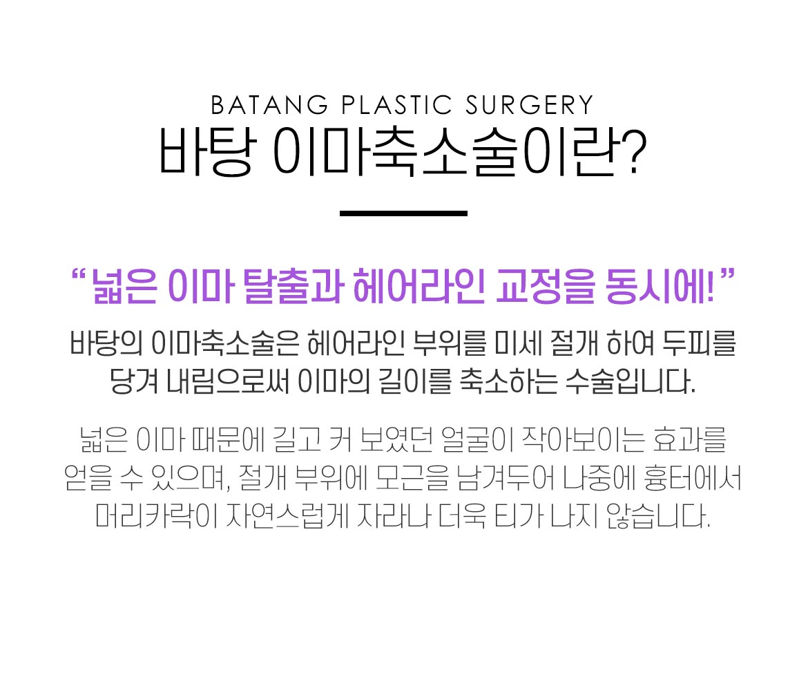 이마축소술이란?