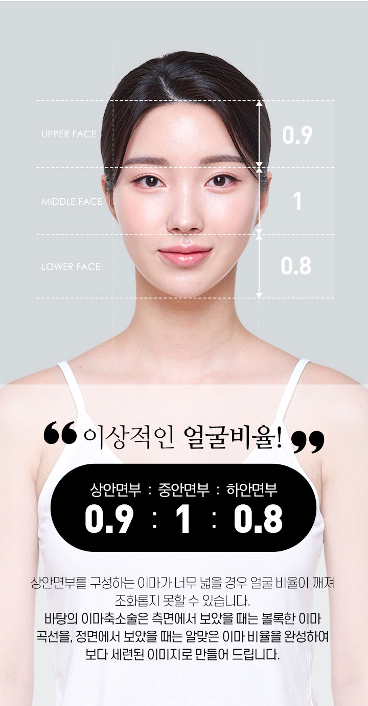 이마축소술