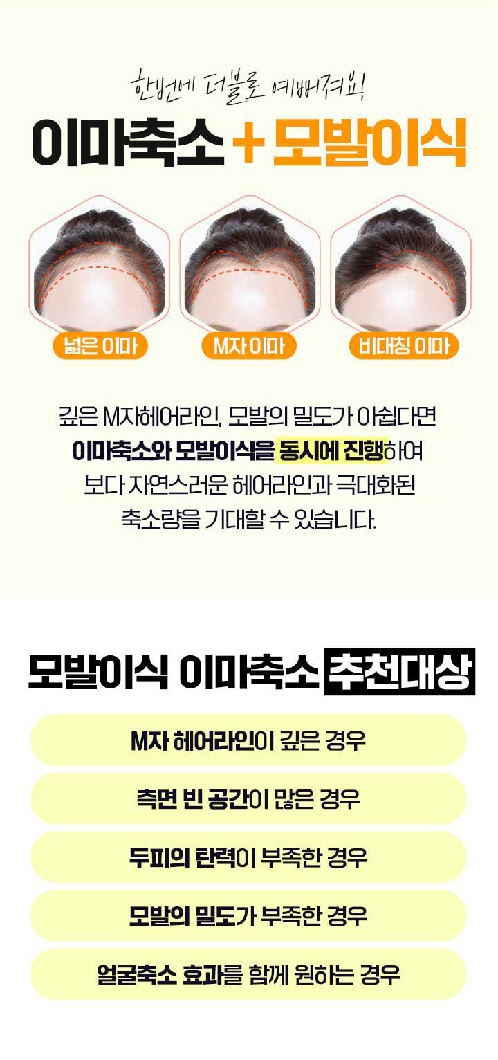 이마축소 모발이식