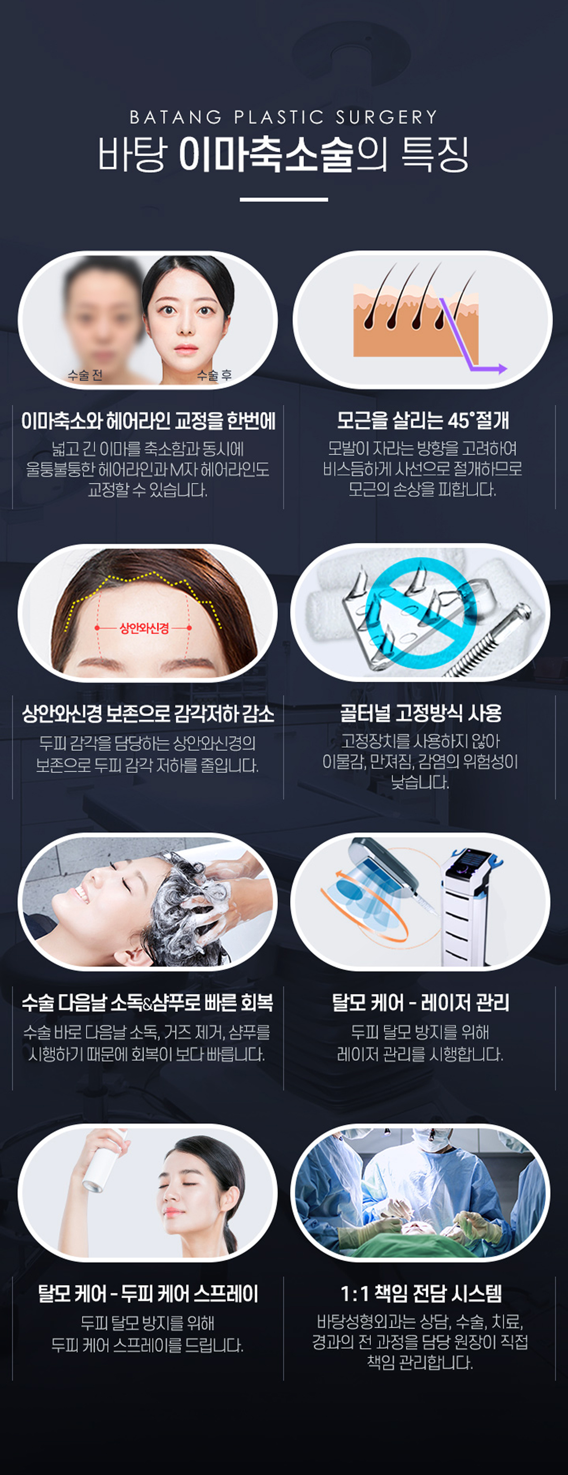 이마축소술의 특징