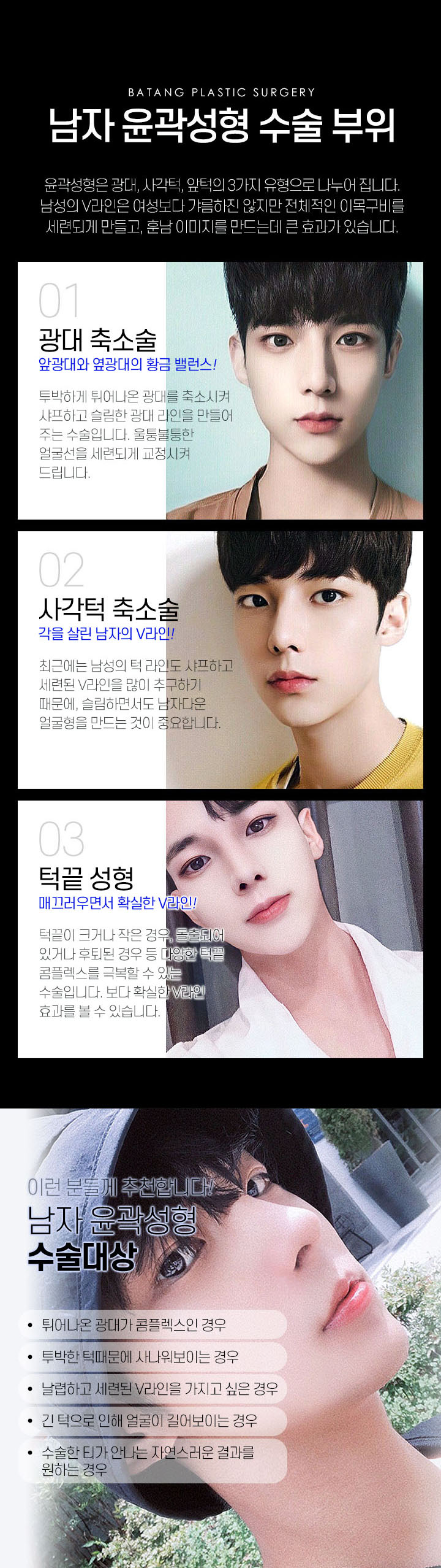 안면윤곽